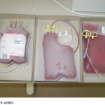 Cryopreservation in Blood Banking: Prolonging Vitality and Elevating Blood Storage and Transportation