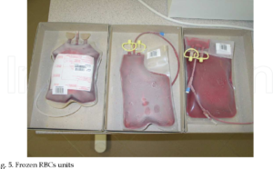 Cryopreservation in Blood Banking: Prolonging Vitality and Elevating Blood Storage and Transportation