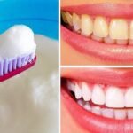 DIY Natural Teeth Whitening Remedies At Home