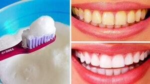 DIY Natural Teeth Whitening Remedies At Home