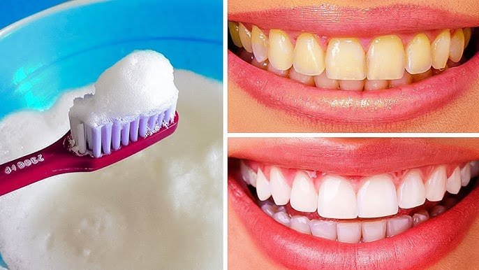 DIY Natural Teeth Whitening Remedies