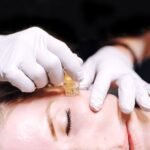 Why Aquagold Is Considered The Most Luxurious Skincare Treatment In Scottsdale?