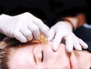Why Aquagold Is Considered The Most Luxurious Skincare Treatment In Scottsdale?